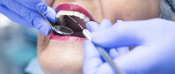 Best Emergency Dentist for Special Needs Patients in Carrollton, MO